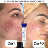 DivaSkin - Crema Tratante